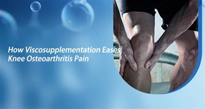 Viskosplementatsiya tizza osteoartriti og'rig'ini qanday engillashtiradi